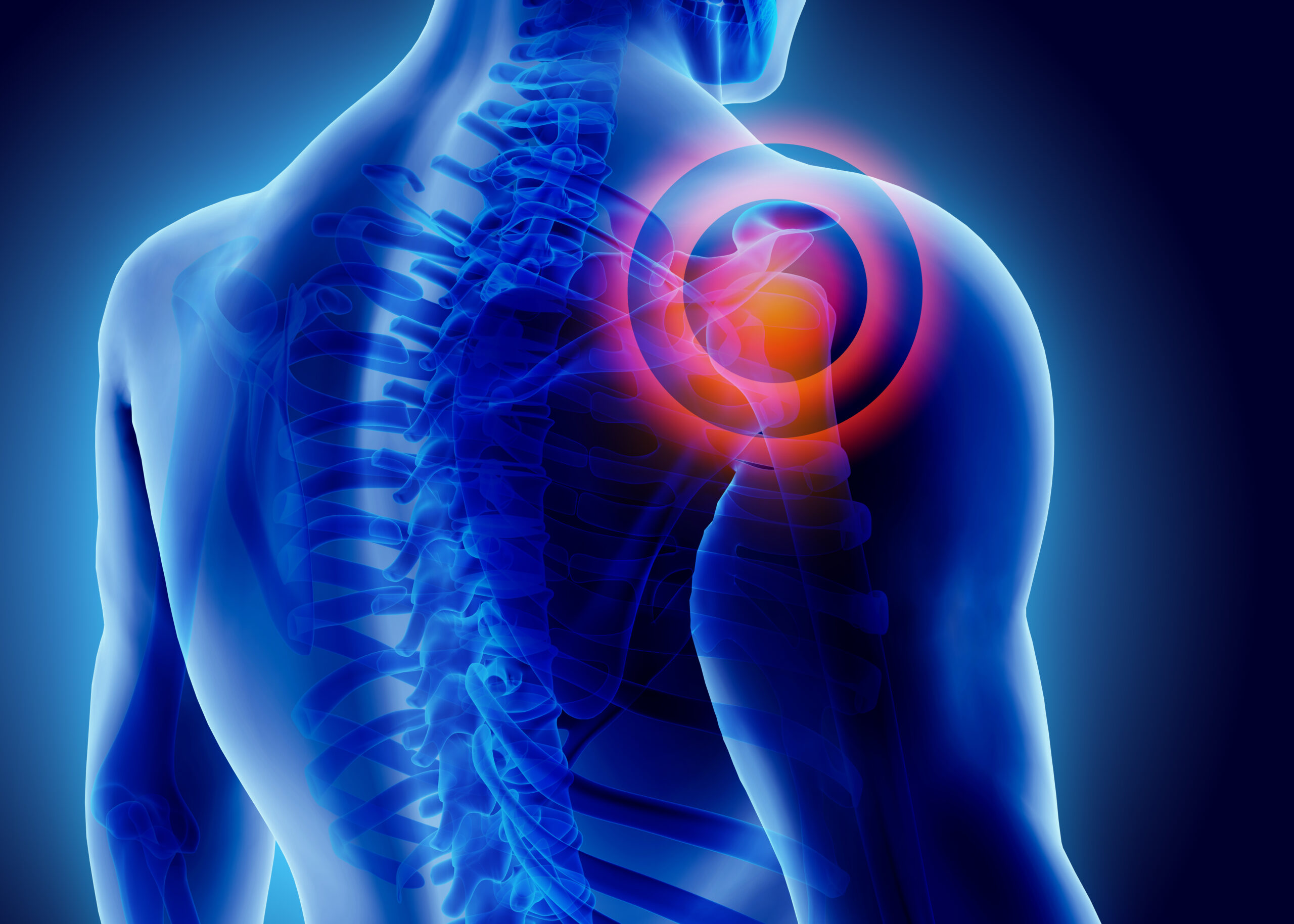 Sports Rehabilitation